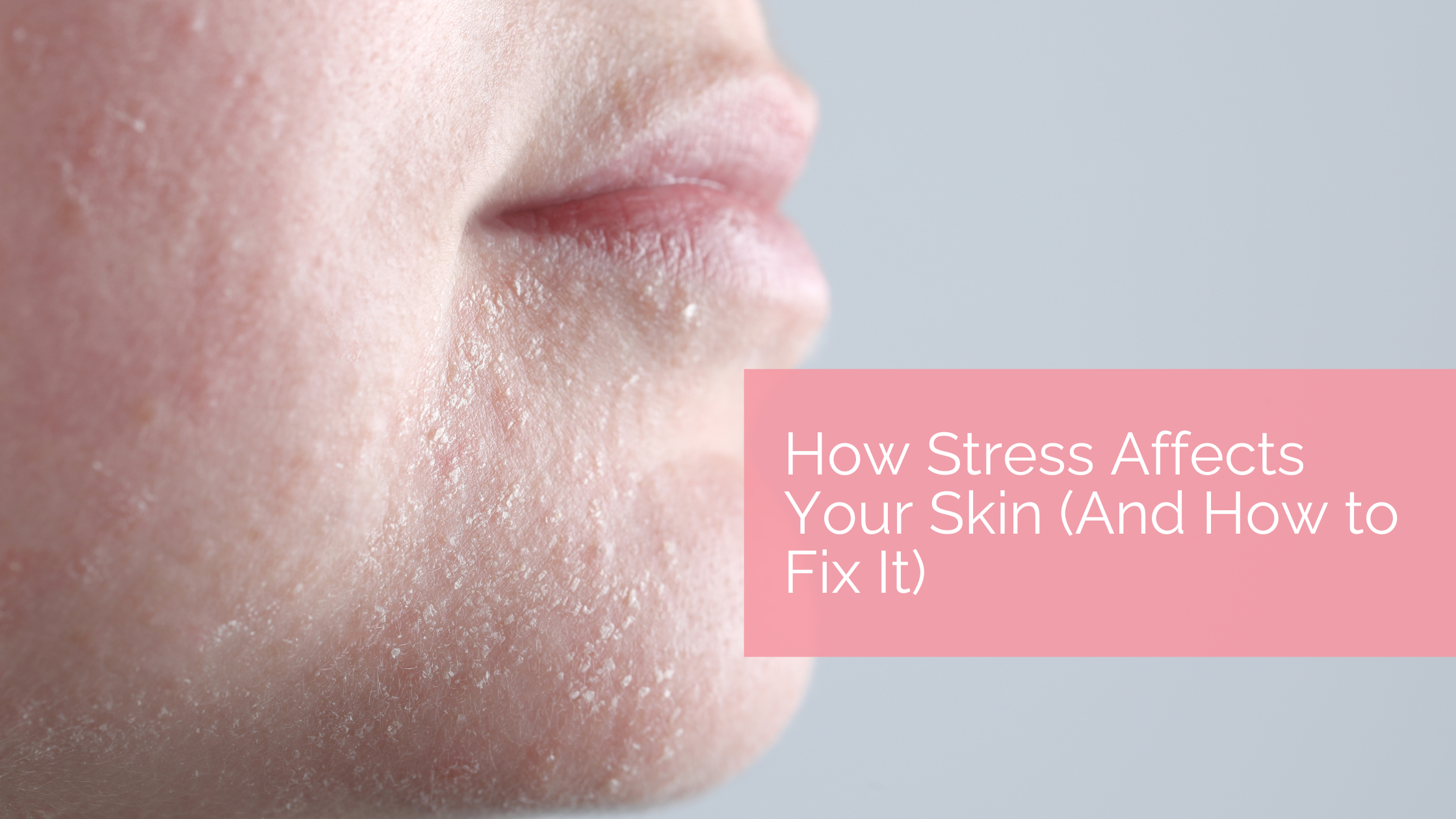 😰 The Effects of Stress on Your Skin — And What You Can Do About It